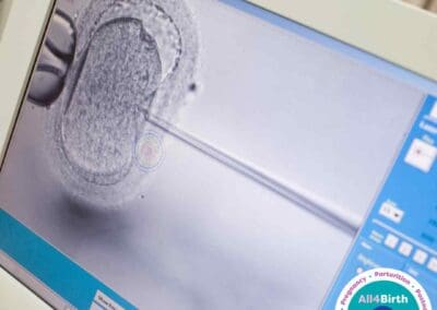 Factsheet- Fertility Series: Understanding ICSI As A Path to Parenthood